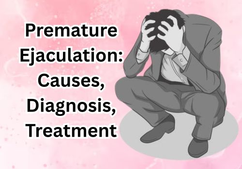 Premature Ejaculation: Causes, Diagnosis, Treatment